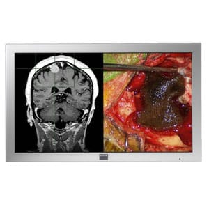 Barco 42 MDSC-2242 LED Surgical Display BASIC CMX
