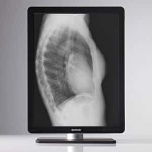 Barco Coronis Grayscale 3MP LED GS MDCG-3221-CB-CMX