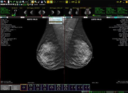 EXA Mammo - Image 6