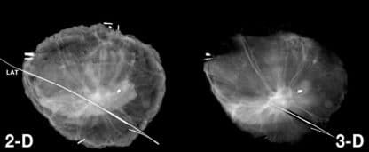 MOZART System - Image 5
